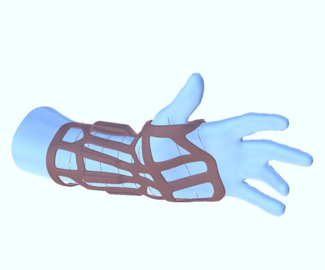 A1 Interactive orthose app
